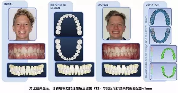 牙齿前沿科技，开启自然美景探索之旅的口腔革命