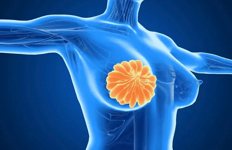 乳腺癌最新治疗方案探索与小巷深处的秘密小店揭秘